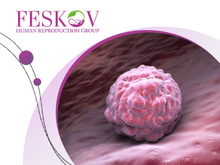 Preparación endometrial para la transferencia de embriones: cómo funciona imagen
