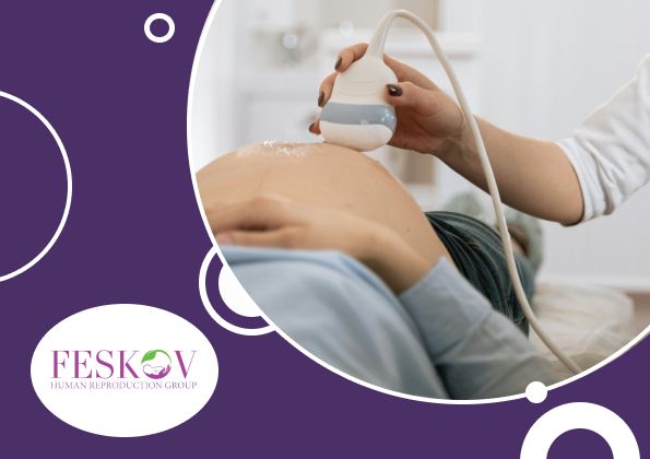 Madre sustituto de los holandés precio