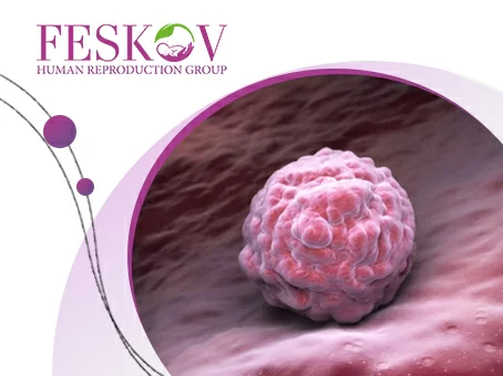 Preparación endometrial para la transferencia de embriones: cómo funciona foto Preparación endometrial para la transferencia de embriones: cómo funciona imagen
